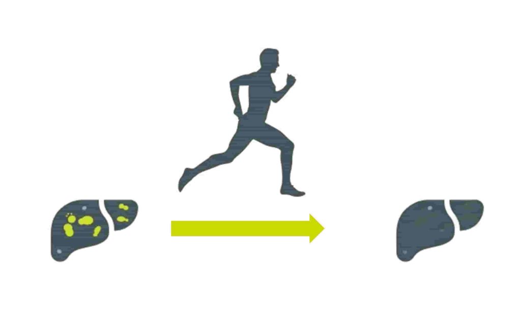 درمان خانگی کبد چرب