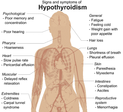 عوارض کم کاری تیروئید