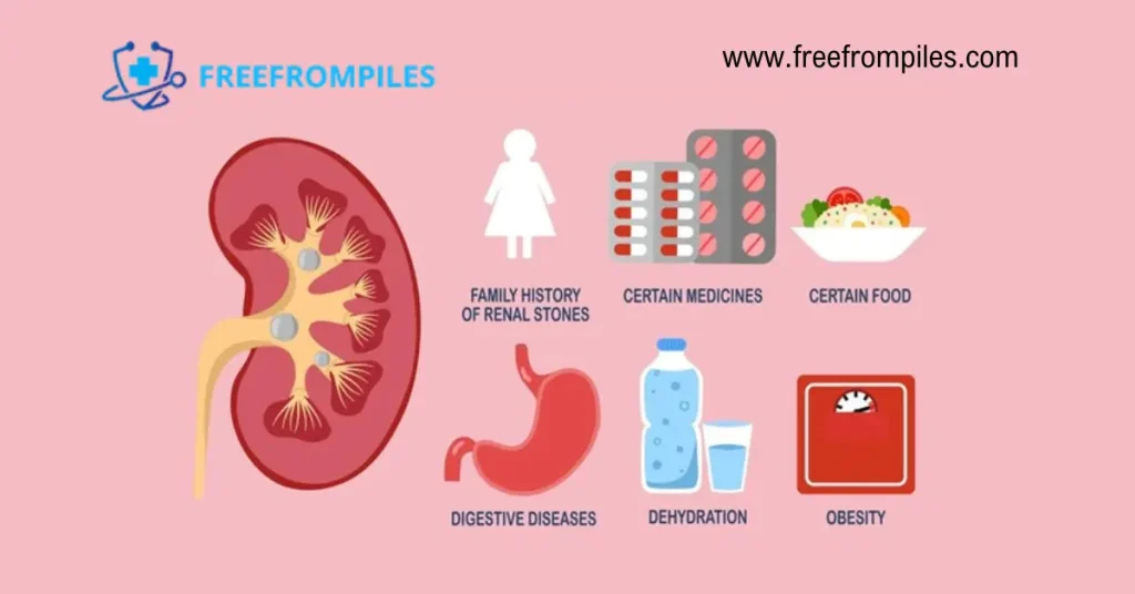 ریسک تشکیل سنگ کلیه