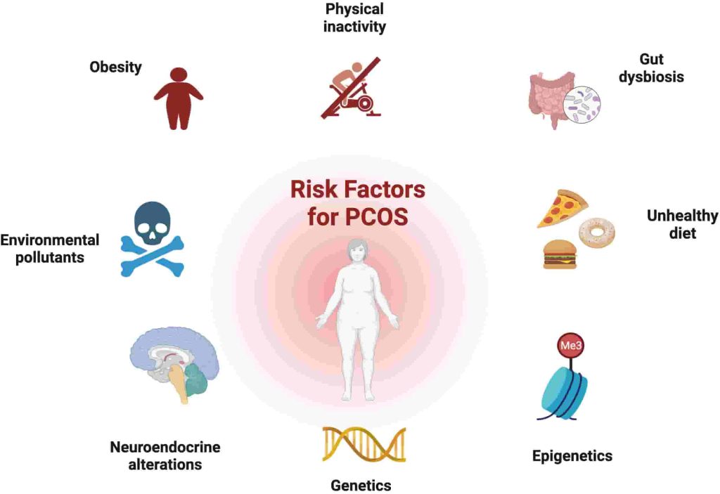 عوامل موثر در ابتلا به سندروم تخمدان پلی کیستیک (PCOS)