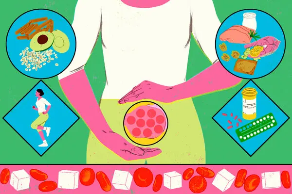 نقش تغذیه در سندروم تخمدان پلی کیستیک (PCOS)