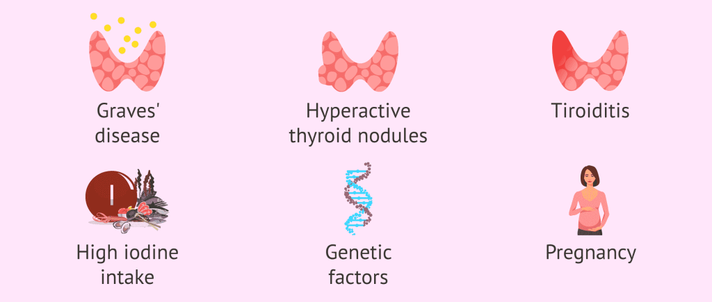 عوامل به وجود آورنده پرکاری تیروئید