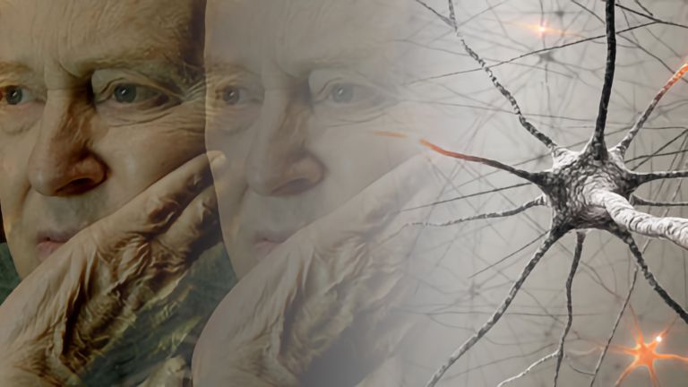 مرحله خفیف بیماری آلزایمر (اولیه)